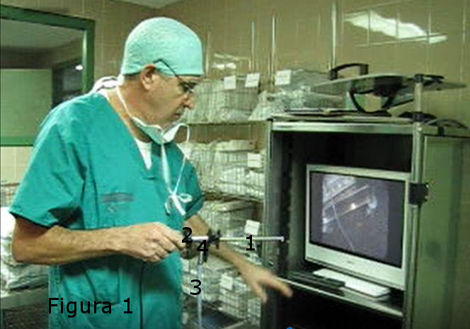  Instrumentos para practicar la Laringoscopia Indirecta. Instruments to practice Indirect Laryngoscopy.