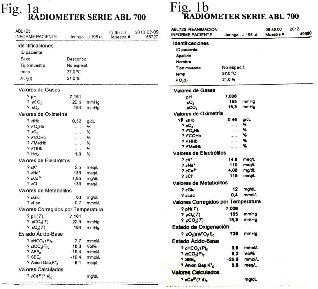 Gasometrías de fluido de catéter epidural y gastrointestinal. Gasometries of epidural and gastrointestinal catheter fluid.