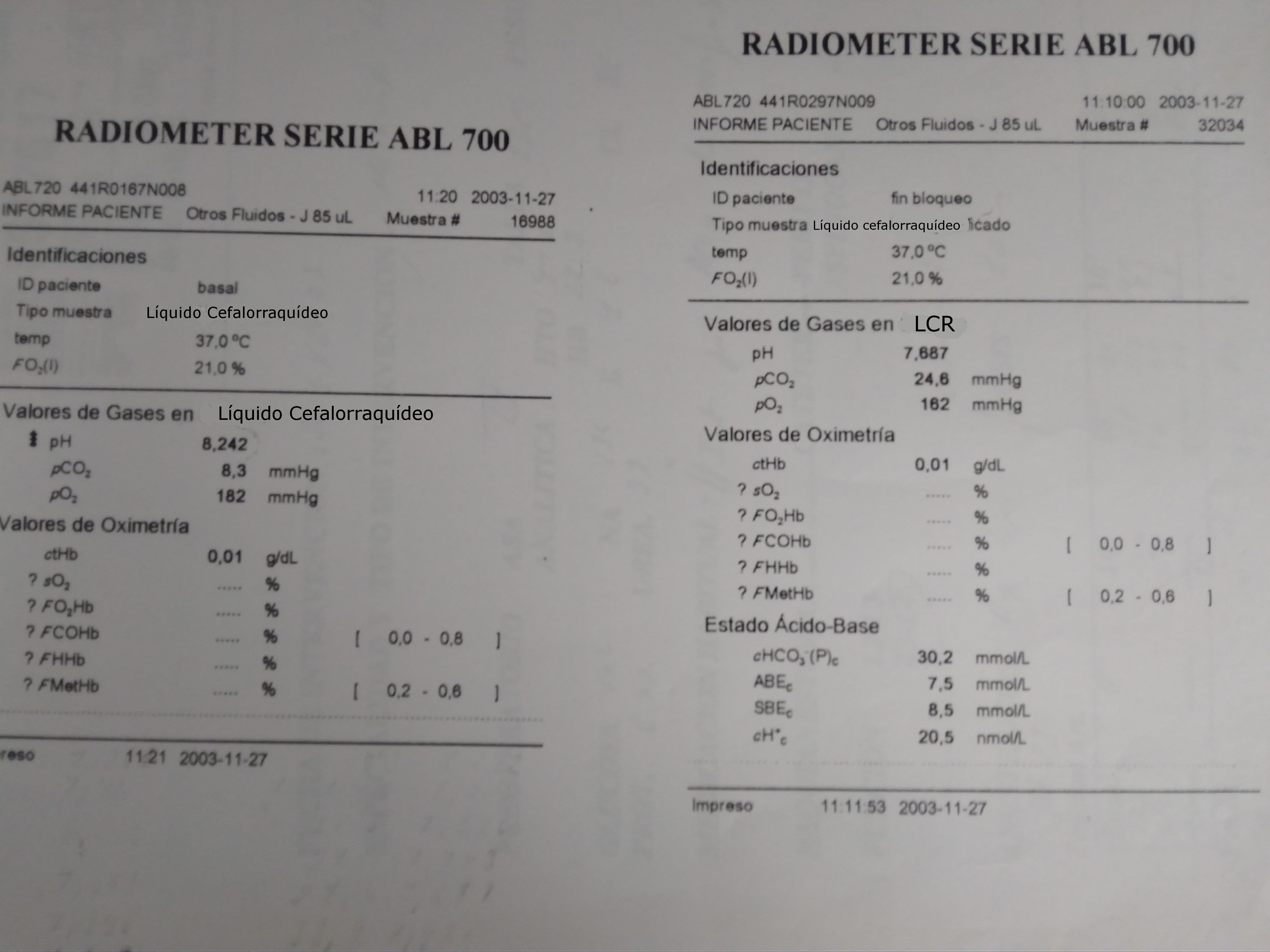  Gasometría de LCR. CSF gasometry.