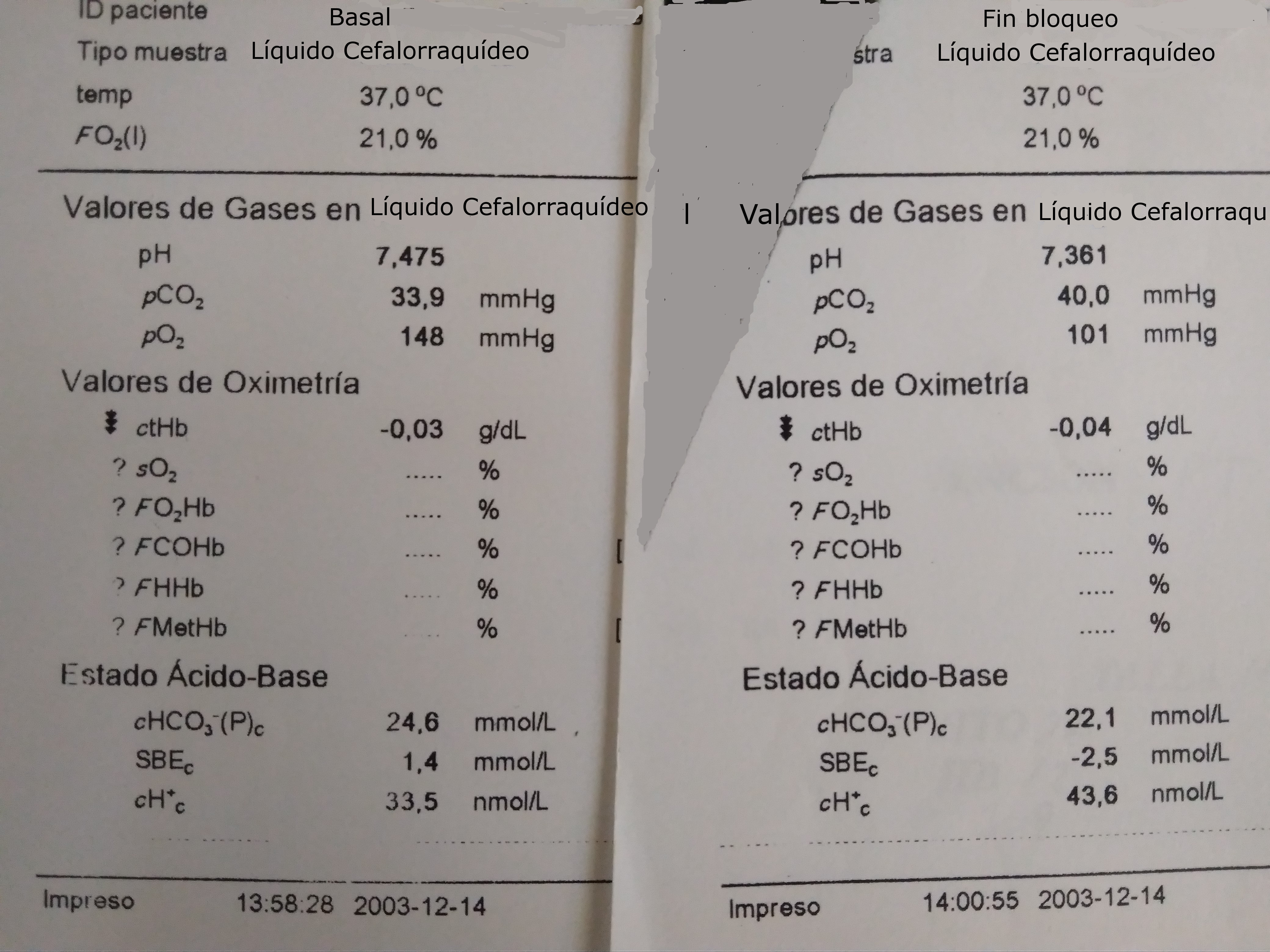  Gasometría de LCR. CSF gasometry.