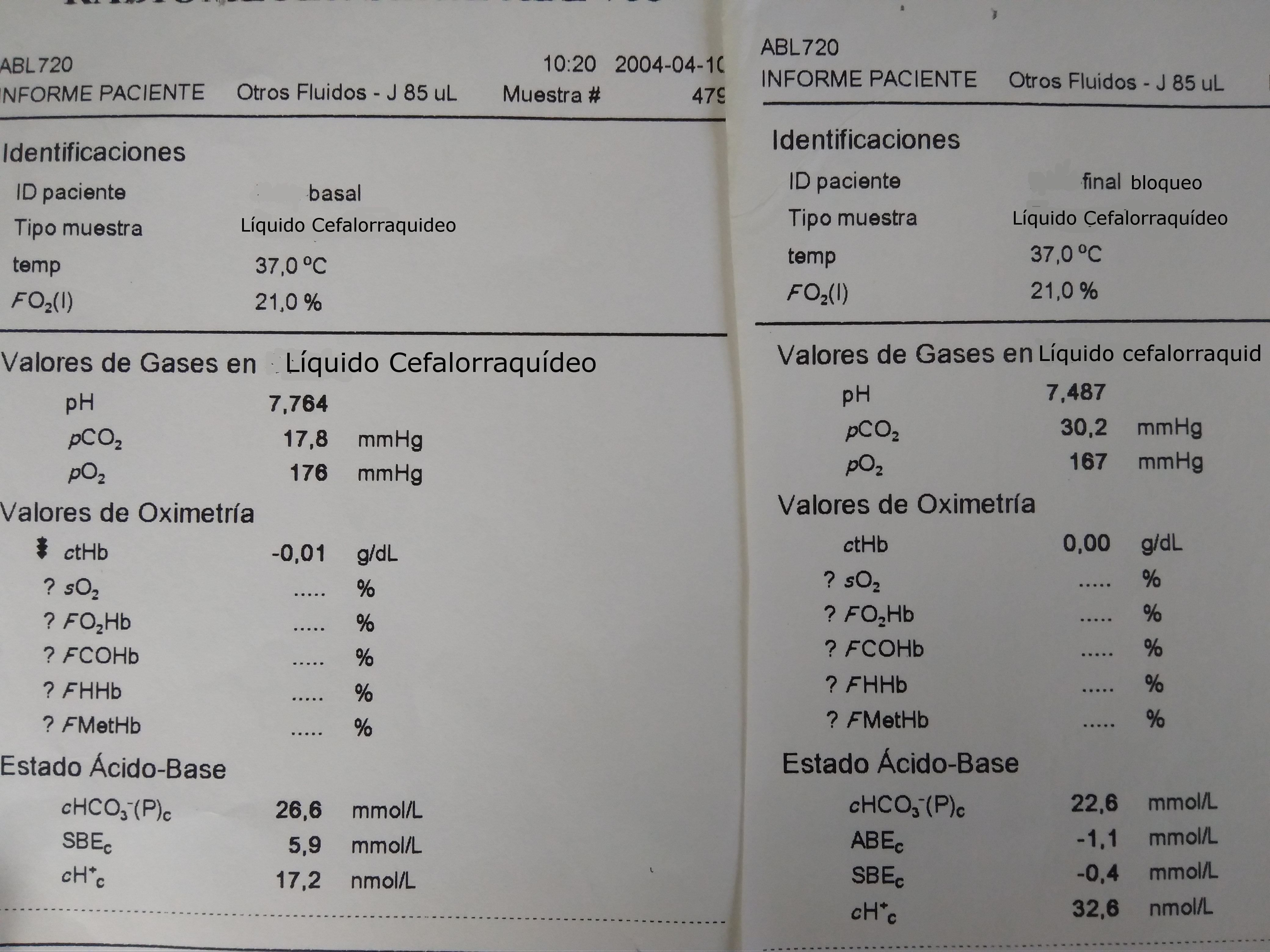 Gasometrías de LCR. CSF gasometries.